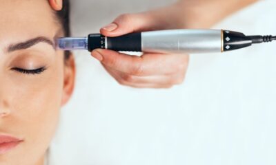 Microneedling