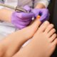 Pedicure Fungal Nail Infection