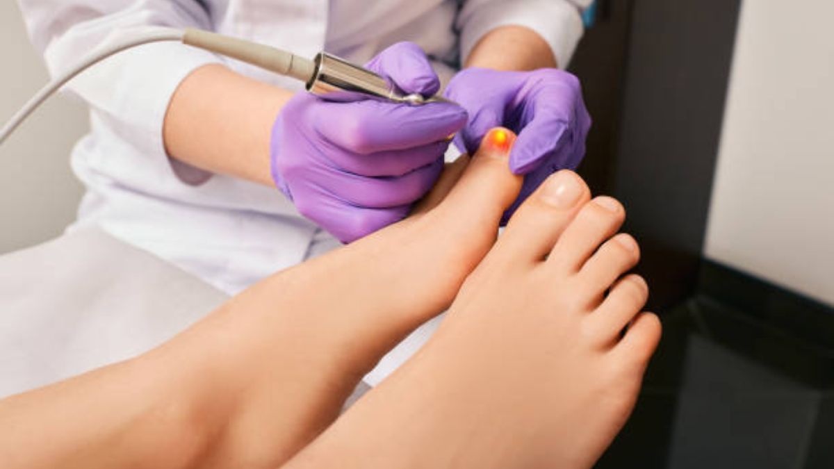 Pedicure Fungal Nail Infection