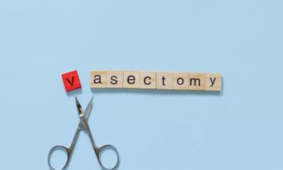 Vasectomy